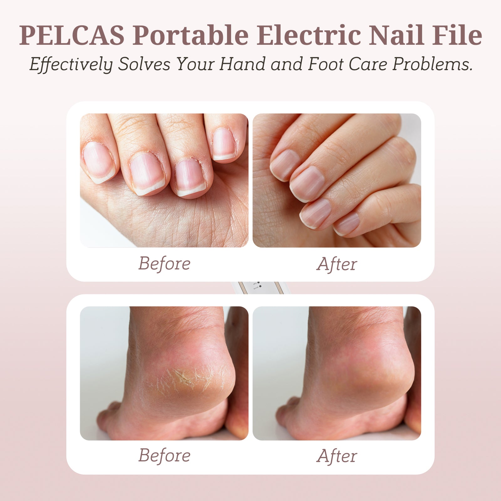 PELCAS Cordless Electric Nail Drill Kit - 5-Speed Professional Manicure & Pedicure Device for Thick Nails with LED Light, 8 Bits & 60 Sanding Bands