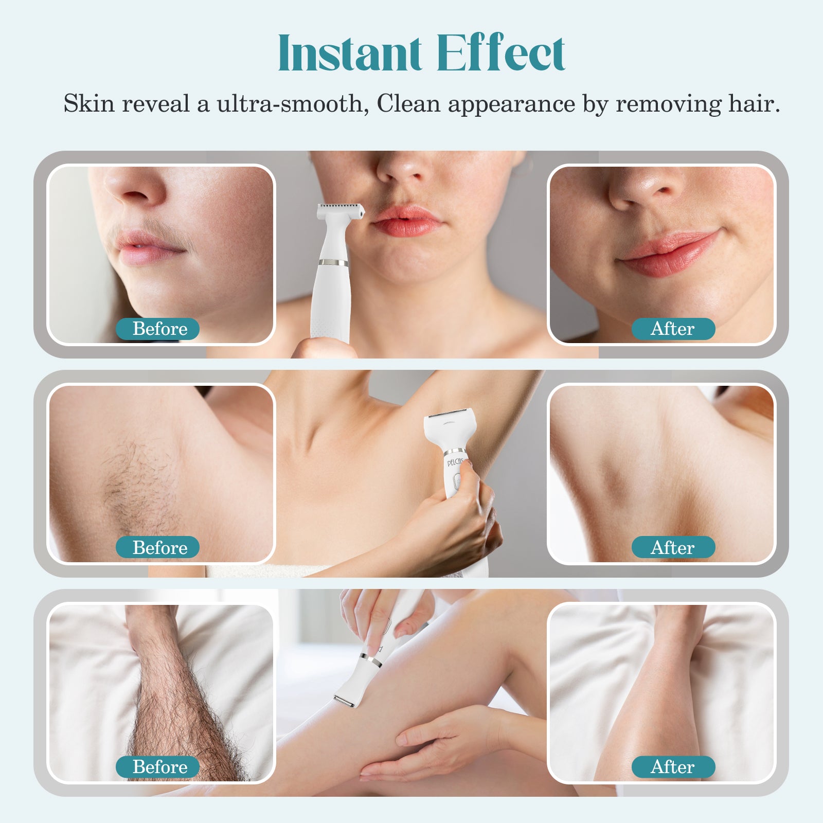 PELCAS 6-in-1 Electric Bikini Trimmer