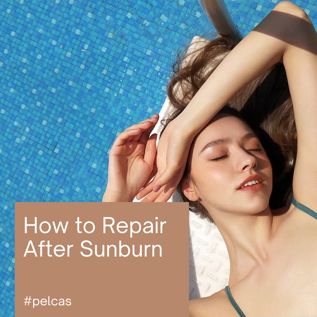 How to Repair After Sunburn: A Comprehensive Guide