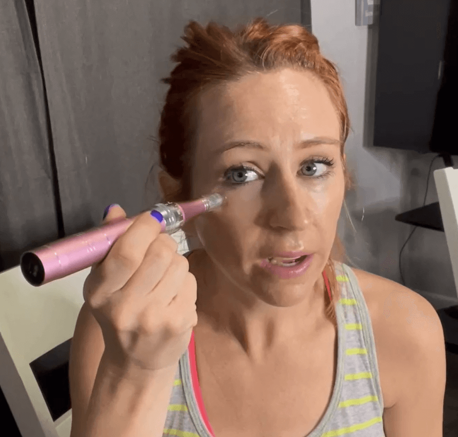 How to Do Microneedling at Home?
