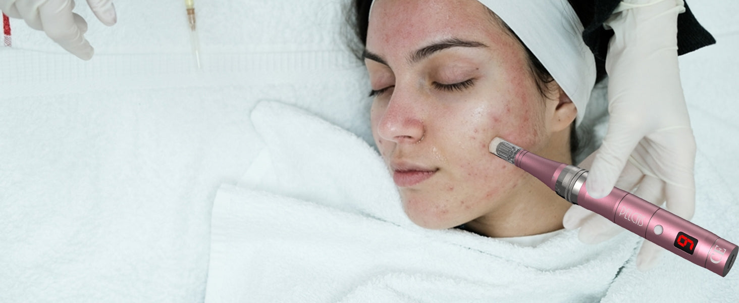 PELCAS Microneedling Pen