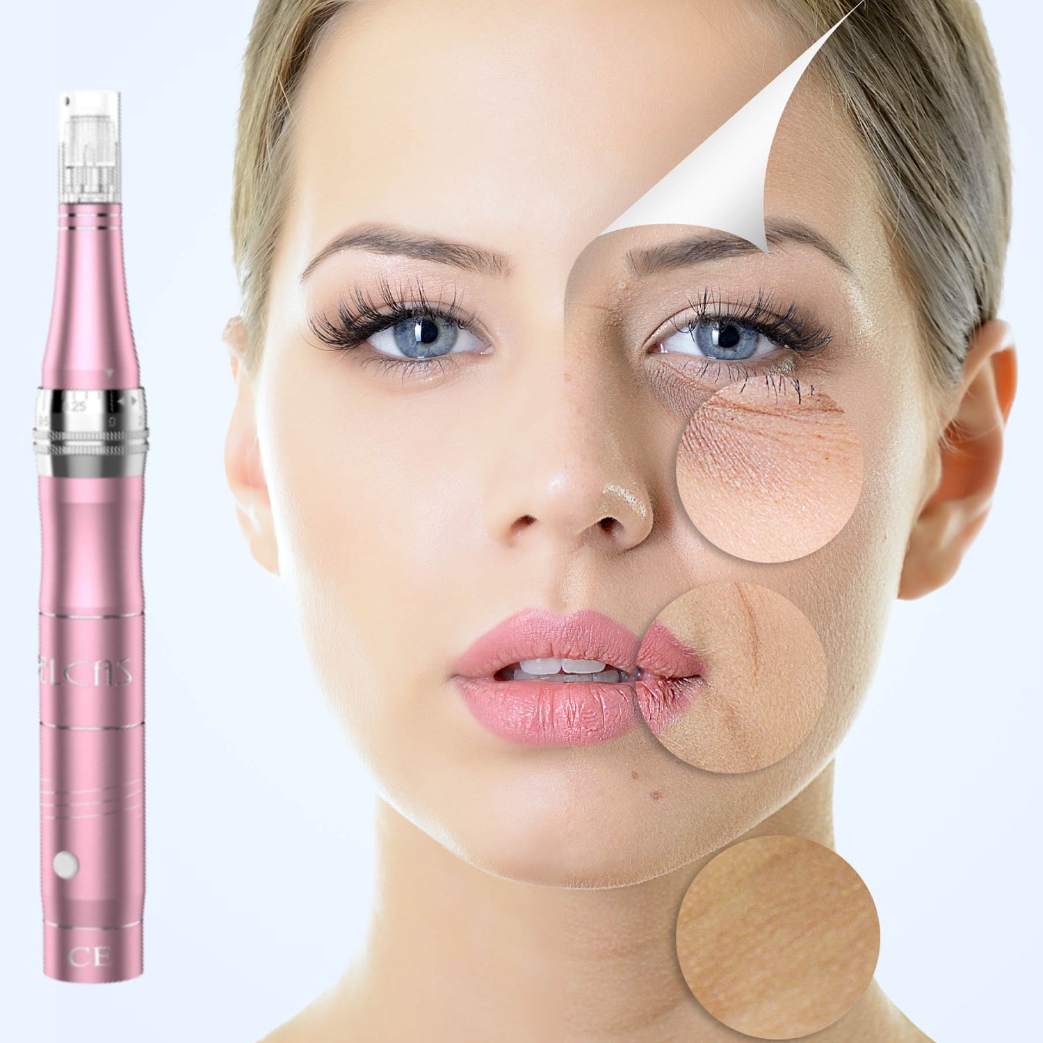 PELCAS Microneedling Pen