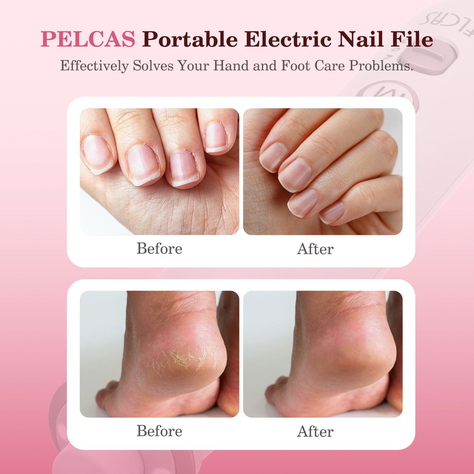 PELCAS 10 Speed Electric Nail File 