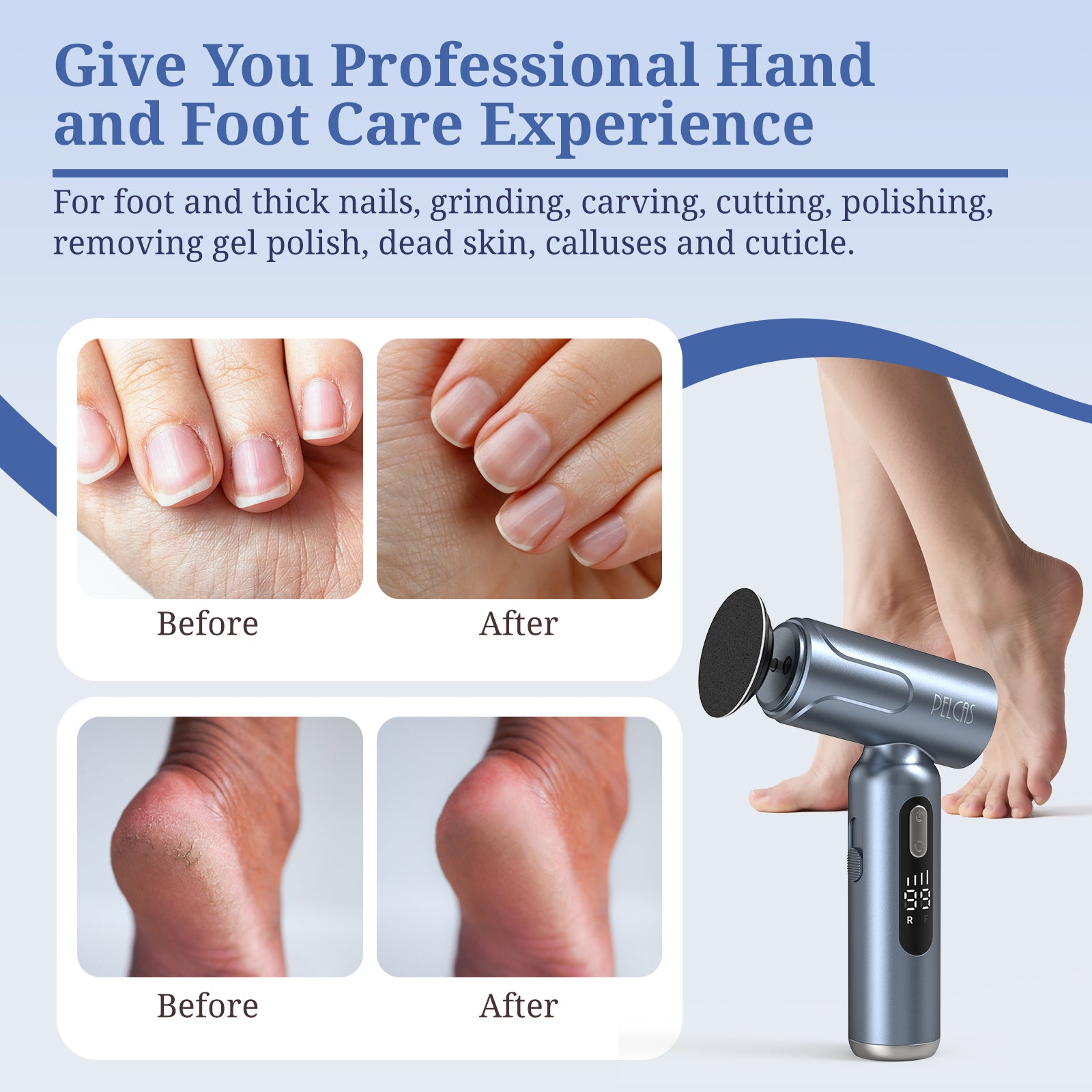 PELCAS Electric Foot File & Callus Remover